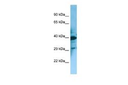 MCHR2 Rabbit anti-Human, Polyclonal, Novus Biologicals 0.1 mL | Buy Online | Novus Biologicals | Fisher Scientific